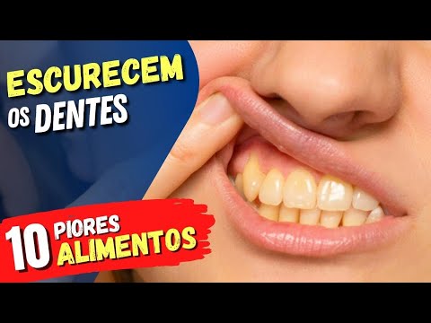 10 ALIMENTOS que ESCURECEM A COR DOS DENTES e Como EVITAR