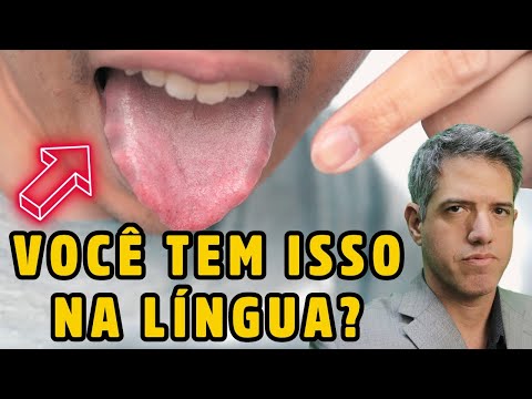 SUA LÍNGUA Pode REVELAR Doenças GRAVES! Saiba Como Identificar - Dr Alain Dutra